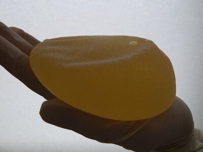 McGhan 410, 185 cc na bijna 15 jaar