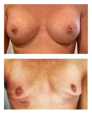 Naamloos-1.jpg (195.31 KiB) 10751 keer bekeken voor en na